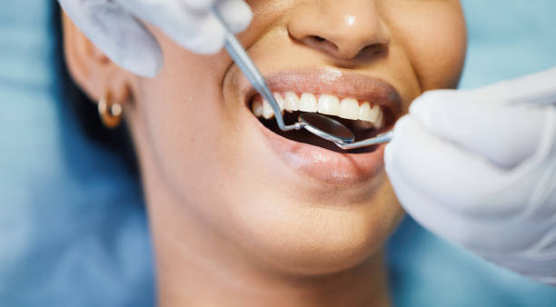 Best Emergency Dentist for Lost Fillings or Crowns in Downers Grove, IL